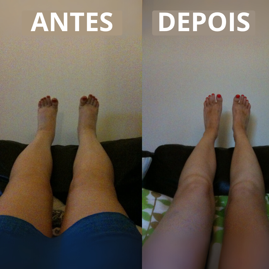 LegTherm™ — Massageador Térmico Sem Fio para Panturrilhas